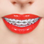 الأقواس محرر الصور